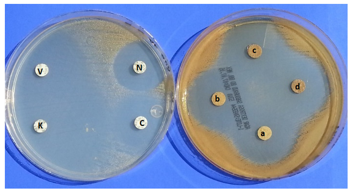 **Figura 4.21. Prueba de inhibición de crecimiento radial de _Malassezia pachydermatis_, donde se observan halos de inhibición al utilizar discos con EEP (derecha) a concentraciones de 2, 4, 8, y 16 mg/mL (a ,b, c y d). Los resultados se compararon con el efecto de antimicóticos conocidos Ketoconazol (K), Voriconazol (V), Nistatina (N) y Clotrimazol (C), sobre la levadura.**