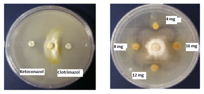 **Figura 4.22. Prueba de inhibición de crecimiento radial de _Microsporum canis_, donde se observan halos de inhibición con discos impregnados con EEP a 4, 8, 12, 16 mg/mL. Los resultados fueron comparados con los halos producidos por Ketoconazol y Clotrimazol.**